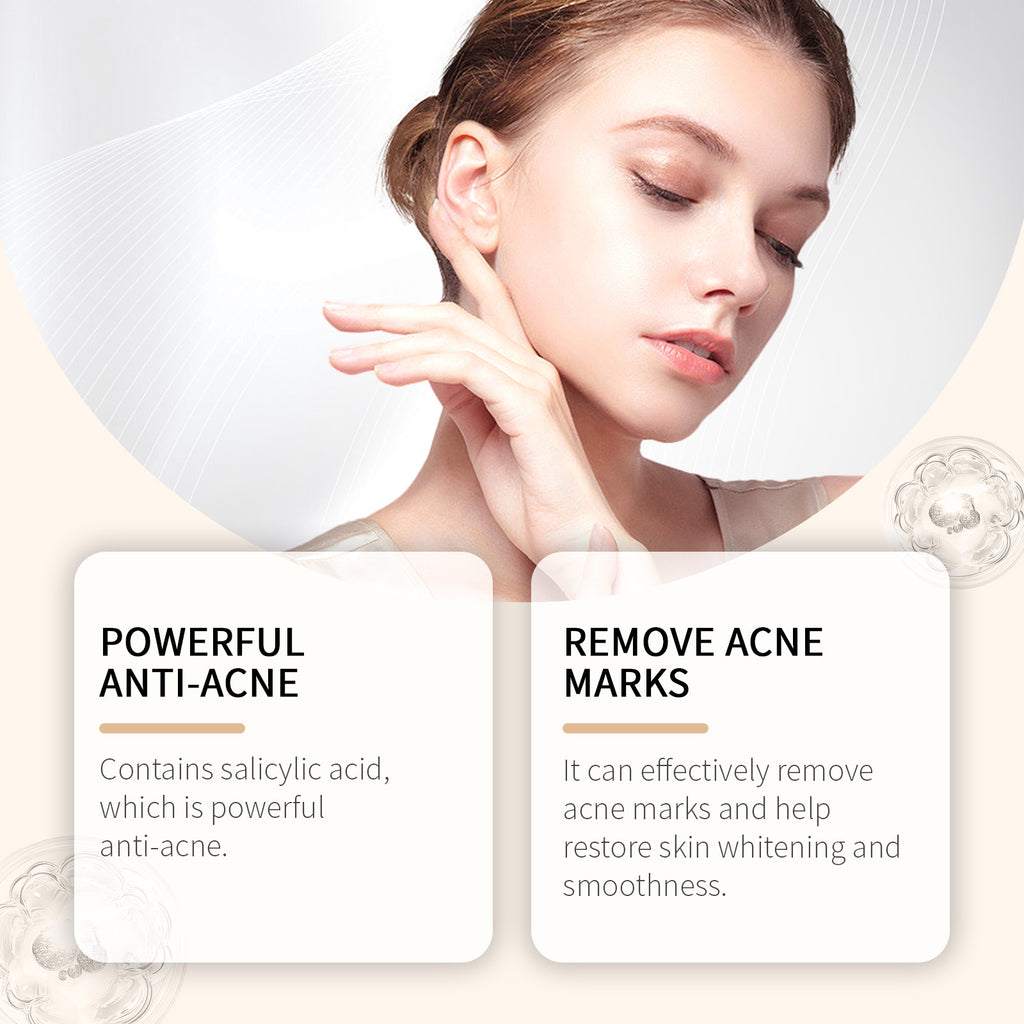 Acne Skincare Solution