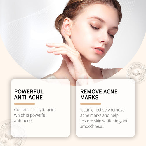Acne Skincare Solution