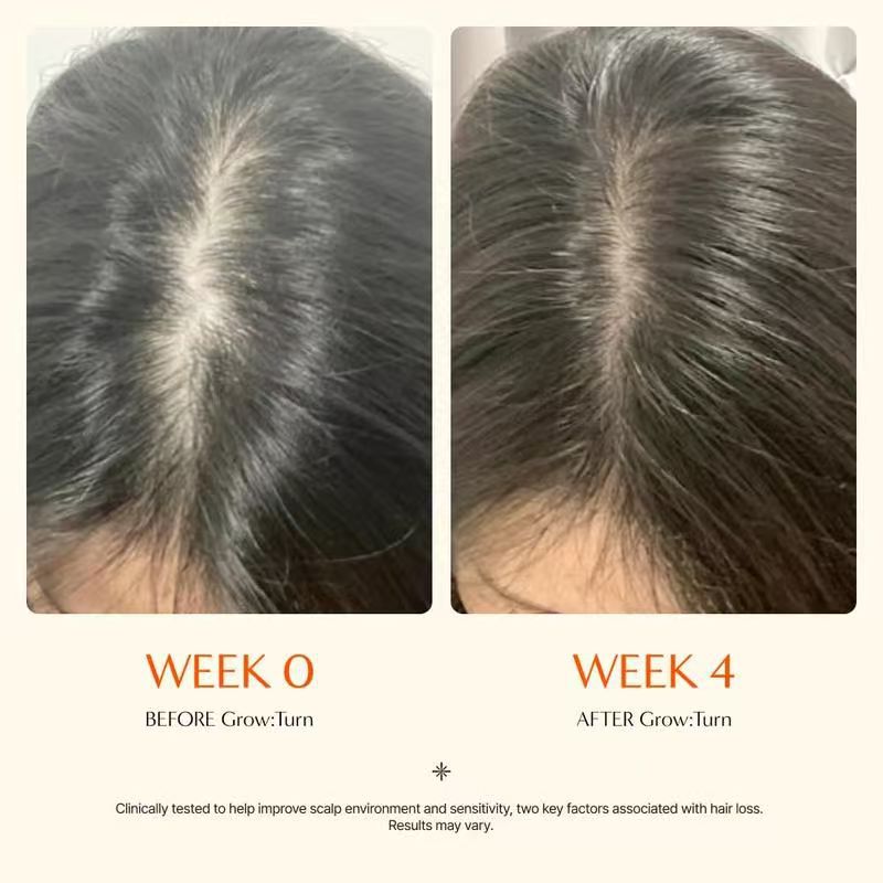 Scalp Care Hair Serum